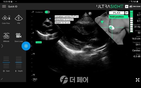 울트라사이트 소프트웨어 활용 예시 / 사진제공=셀바스