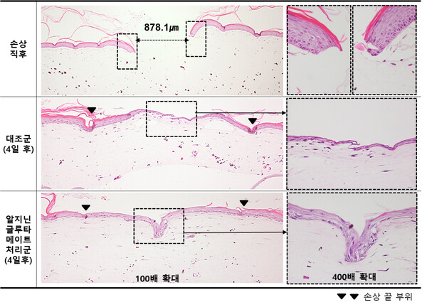 LG생활건강은 인공 피부 손상 후 회복 촉진 평가를 진행한 결과, '알지닌 글루타메이트'를 사용한 실험군이 대조군 대비 최대 2.8배 상처 회복이 빨라지는 것을 확인했다. 사진= LG생활건강